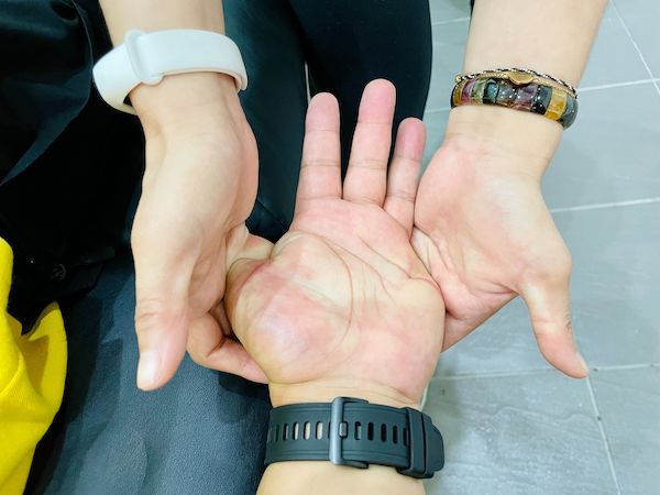 雙人按摩術-肩頸痠痛-5-01