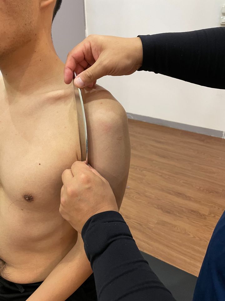 在肌肉緊繃的狀態下，身體必須要透過按摩、伸展、筋膜球都有相當優異的紓解效果。而筋膜刀是讓筋膜層的水分和玻尿酸迅速回填，藉此來達到肌群需要放鬆效益。