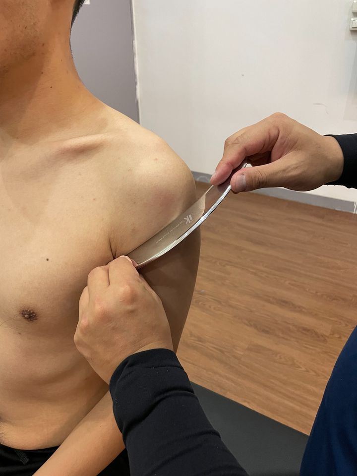 在肌肉緊繃的狀態下，身體必須要透過按摩、伸展、筋膜球都有相當優異的紓解效果。而筋膜刀是讓筋膜層的水分和玻尿酸迅速回填，藉此來達到肌群需要放鬆效益。